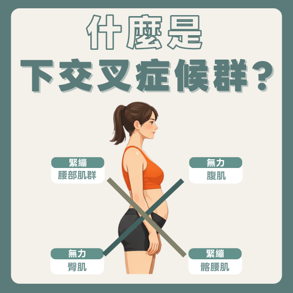 高雄骨盆前傾治療，帶你了解下交叉症候群