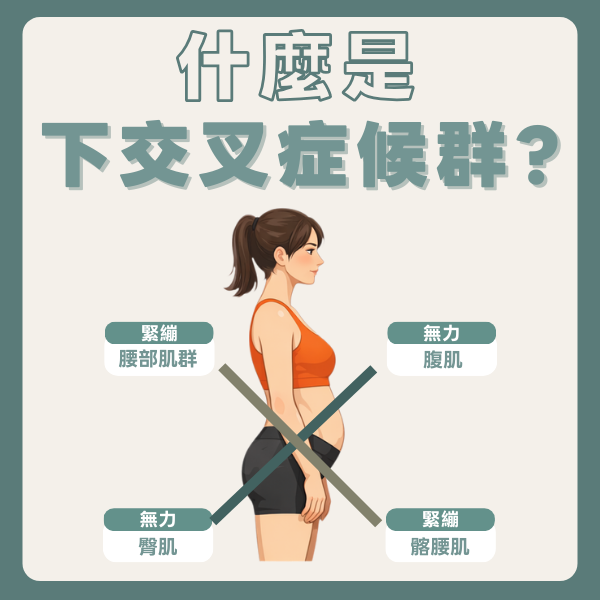 高雄骨盆前傾治療｜帶你了解下交叉症候群