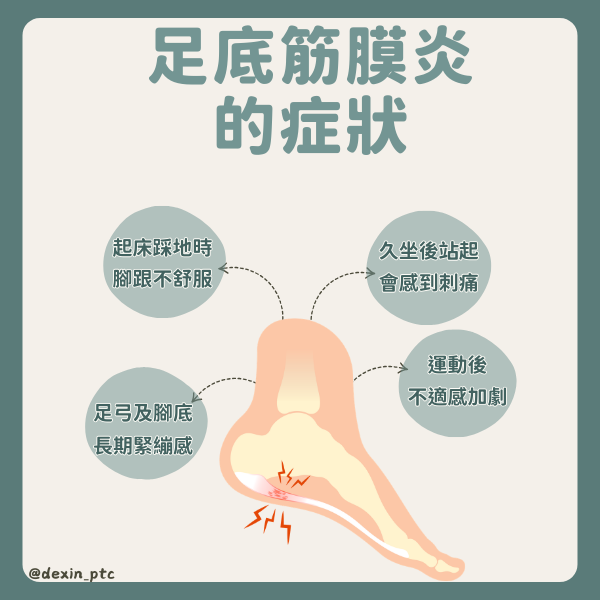 腳底刺痛不舒服｜帶你認識足底筋膜炎治療